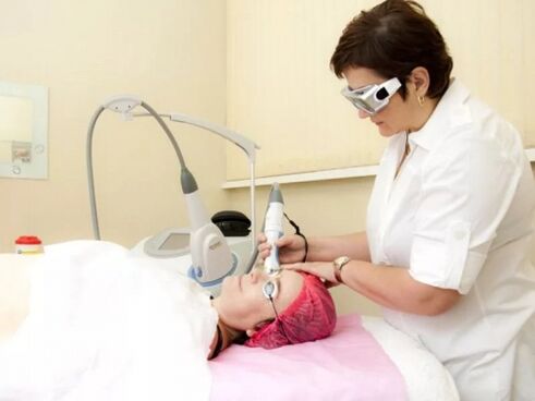 Die Kosmetikerin führt das Laser-Resurfacing-Verfahren durch. 